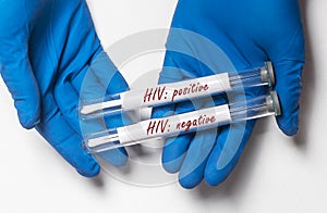 Test tubes with positive and negative result of HIV analysis in doctor hand