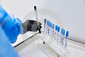 Test tubes rack with madical samples on the table at the modern laboratory