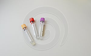 Test tubes rack with madical samples on the table at the modern laboratory