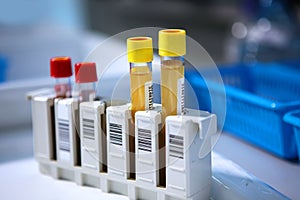 Test tubes with yellow biomaterials in the laboratory. The concept of medical research.Clinical and diagnostic laboratory.