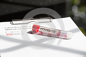 Testing kit for nCov, covid - 19, corona virus testing tube in laboratory photo