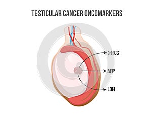 Testis tumor markers. Testicular cancer releasing hormones and enzymes photo