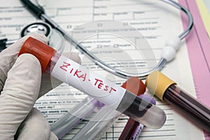 Tests For Research Of Zica virus (ZIKV)