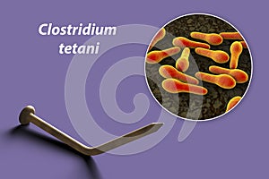 Tetanus. Bacteria Clostridium tetani and rusty metal nail