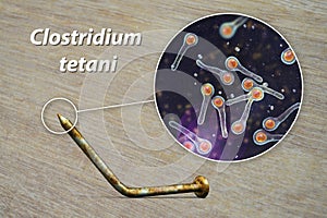 Tetanus. Bacteria Clostridium tetani and rusty metal nail