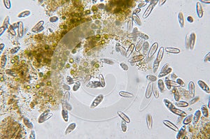 Tetrahymena is a genus of unicellular ciliated protozoan