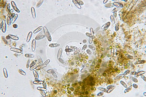 Tetrahymena is a genus of unicellular ciliated protozoan photo