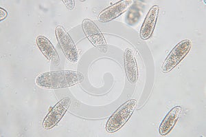 Tetrahymena is a genus of unicellular ciliated protozoan photo