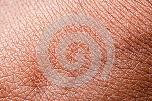 Texture of the skin.Dark skin of woman hand macro. Human skin texture background