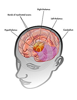 Thalamus & hypothalamusâˆš