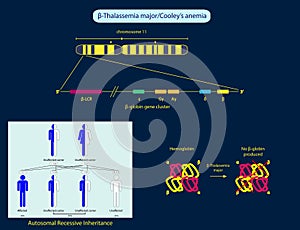 Thalassemia major