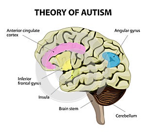 Theory of autism photo