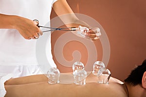 Therapist Giving Cupping Therapy To Man