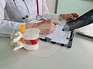 Therapist holding anatomical model of vertebras with intervertebral hernia