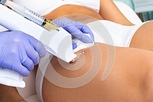 Therapist reducing cellulite with micro needle technology on female thigh