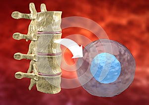 Therapy with stem cells taken from the bone marrow to treat diseases of the human body