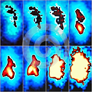 Nuclear renal scan eight images function collage