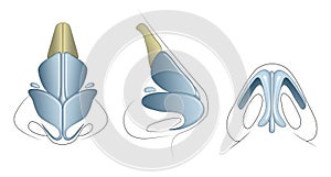 The nasal cartilages are the septal, lateral, major alar, and minor alar cartilages