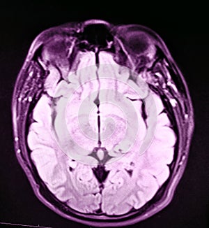 Cerebro patología un examen 