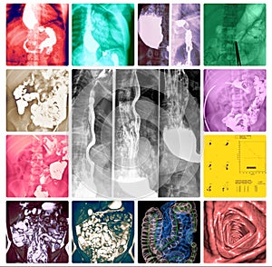 Gastroenterology system exams colorful collage