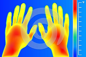 Thermal imager Human hands and finger. The image of a arms using Thermographic camera. Scale is degrees Fahrenheit.