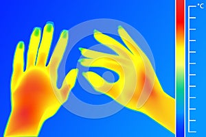 Thermal imager Human hands. The image of a female arms using Thermographic camera. Scale is degrees Fahrenheit.