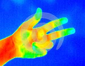 Thermograph-3 fingers