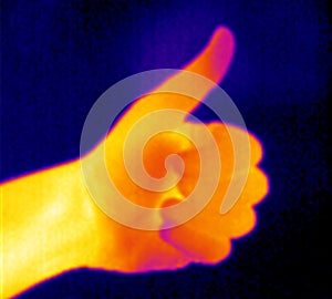 Thermograph-Thumb up