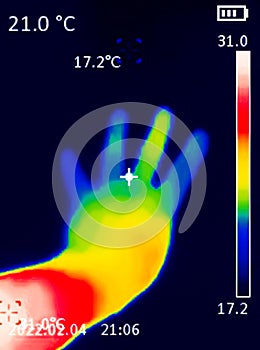 A thermographic image of a hand with a human heart, showing different temperatures in different colors, from blue indicating