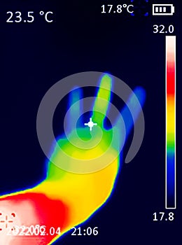 A A thermographic image of a hand with a human heart, showing different temperatures in different colors, from blue indicating