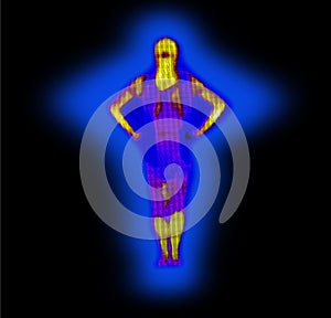 Thermographic image of the human body