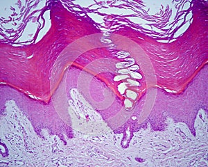 Thick skin. Epidermis layers