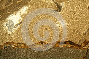 Thin section of Triassic carbonate under the microscope