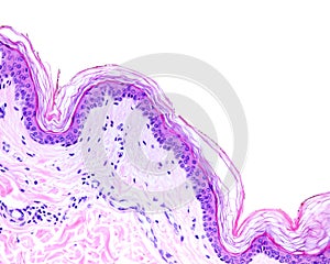 Thin skin. Hematoxylin-eosin