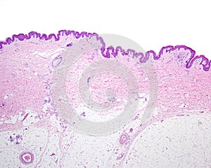 Thin skin. Hematoxylin-eosin