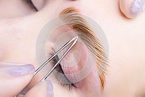 Thinning of eyebrow hairs after eyebrow coloring and lamination procedures photo
