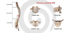 Thoracic vertebrae T10