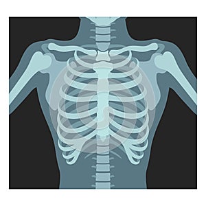 Thorax x-ray. Lungs radiological control. Radiography of chest, ribs., torso. Fluorography. photo