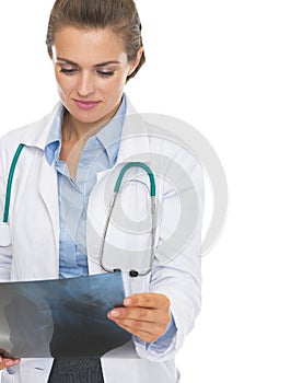 Thoughtful doctor woman checking fluorography