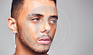 Thoughtful Young Man With Skin Pigmentation Disorder Looking Off Camera In Studio photo