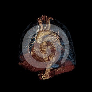 Three-dimensional color computed tomography image of the heart and lungs isolated on black photo