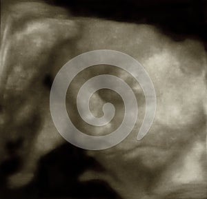 Three-Dimensional sonogram photo