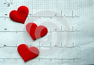 Three hearts are arranged vertically against the background of an electrocardiogram.