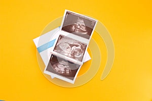 Three snapshots of ultrasound on a silver box