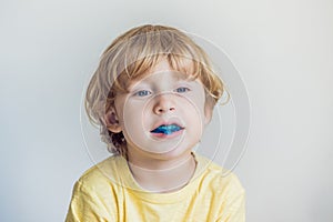 Three-year old boy shows myofunctional trainer to illuminate mouth breathing habit. Helps equalize the growing teeth and correct photo