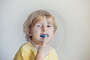 Three-year old boy shows myofunctional trainer to illuminate mouth breathing habit. Helps equalize the growing teeth and correct b photo