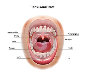 Throat and tonsils. Oral cavity. Medical scheme.