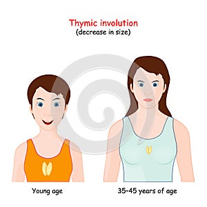 Thymic involution. decrease size of the thymus with age