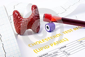 Thyroid and cholesterol concept photo. Model of thyroid gland, test tubes with blood for lipids diagnosis, printed tape with ECG a