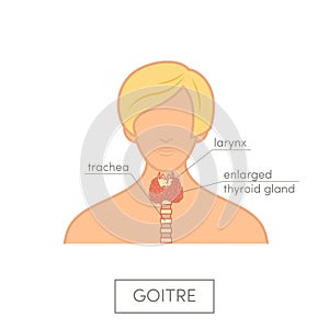 Thyroid gland anatomy of female